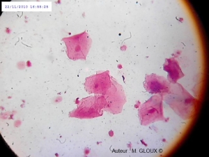 Micro loupe Lesitedemonprofdesvt Micro loupe Lesitedemonprofdesvt